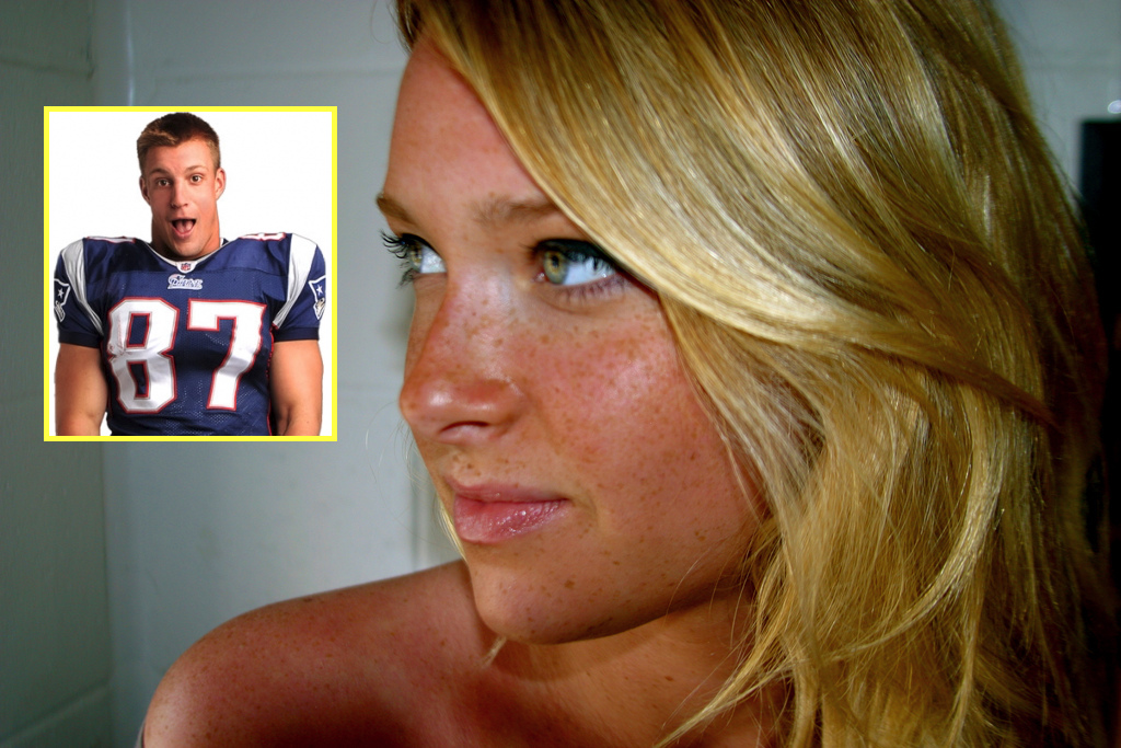 Camille Kostek facelift