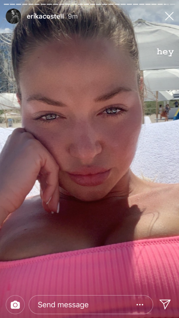 Did Erika Costell Undergo Plastic Surgery Boob Job Botox Facelift And More Hollywood