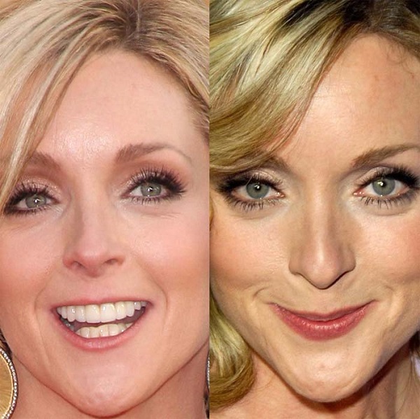 Jane Krakowski facelift