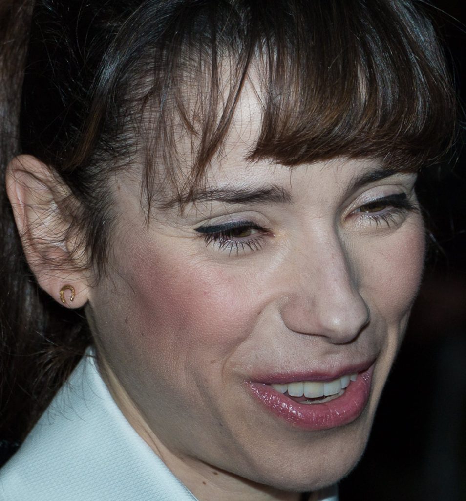 Sally Hawkins botox