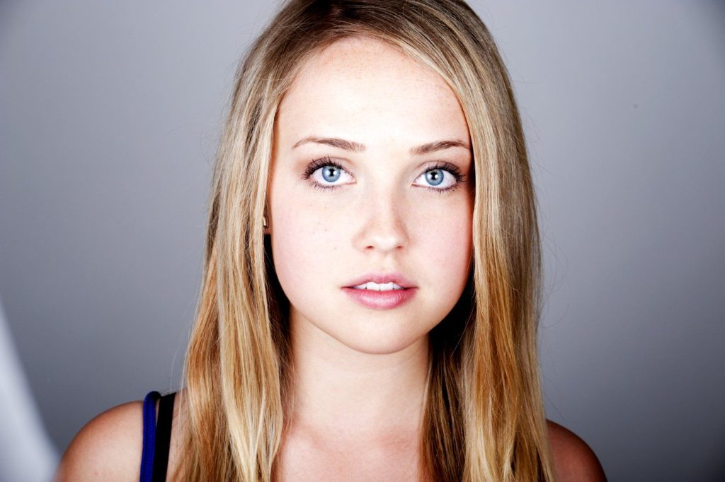 Siobhan Williams nose job lips facelift