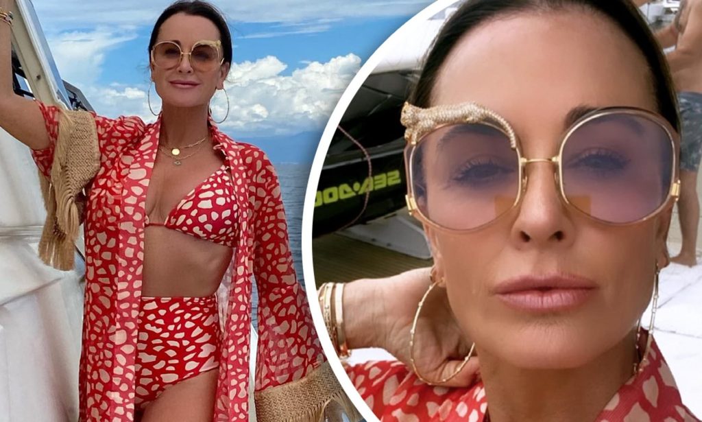 Kyle Richards Liposuction