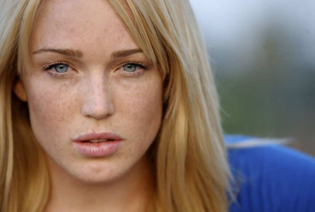 Caity Lotz Cosmetic Surgery