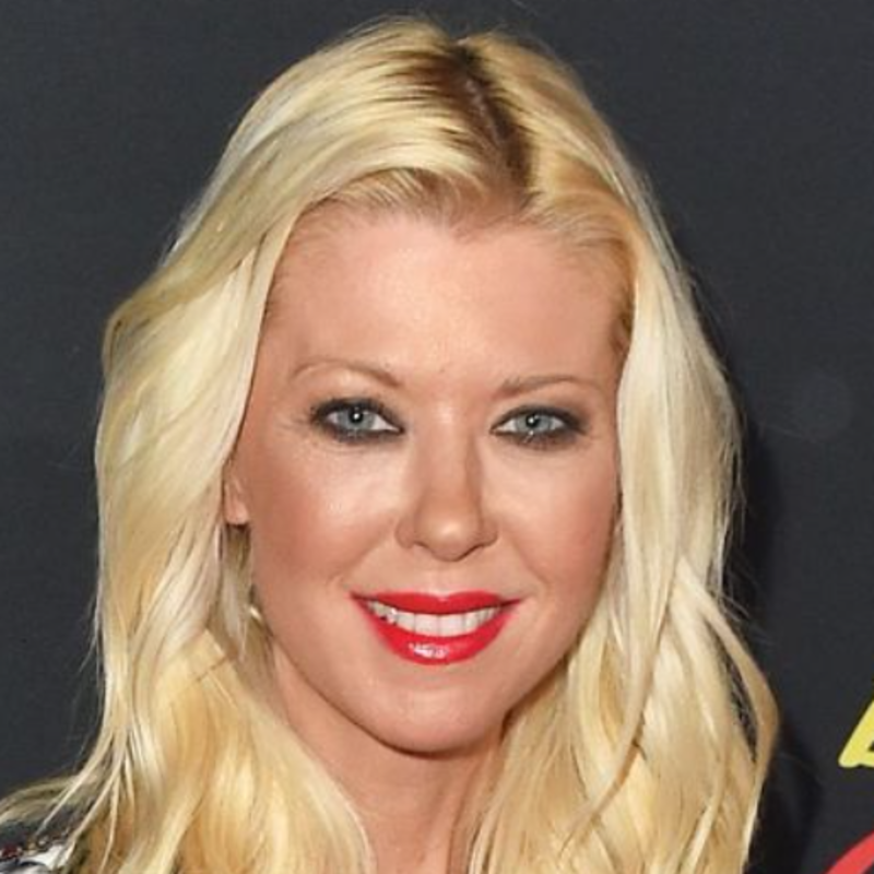 Tara Reid Cosmetic Surgery Face